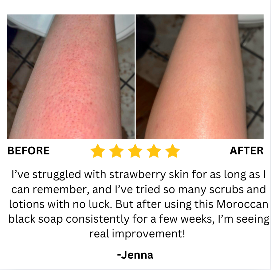 Moroc Black Soap (Buy 1 Get 1 Free)