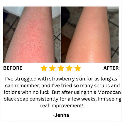 Moroc Black Soap (Buy 1 Get 1 Free)