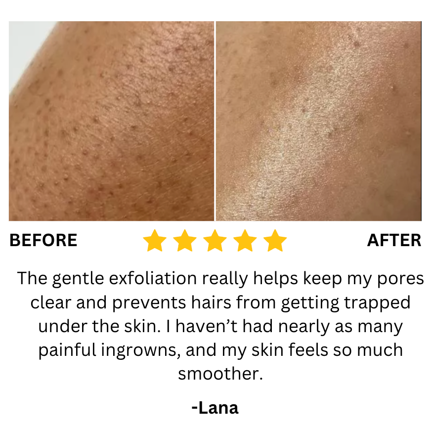 Moroc Black Soap (Buy 1 Get 1 Free)