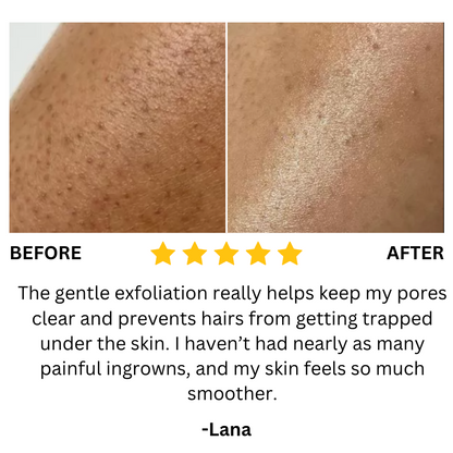 Moroc Black Soap (Buy 1 Get 1 Free)