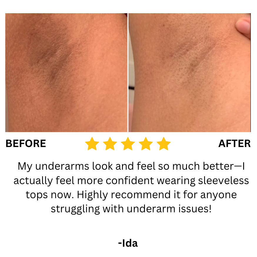 Moroc Black Soap (Buy 1 Get 1 Free)