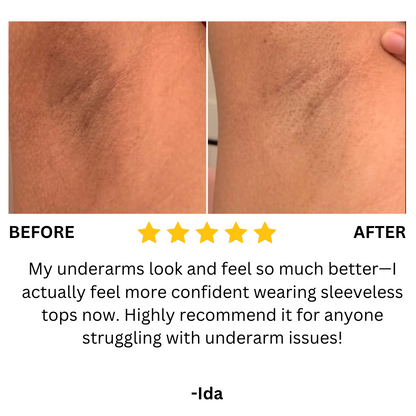 Moroc Black Soap (Buy 1 Get 1 Free)